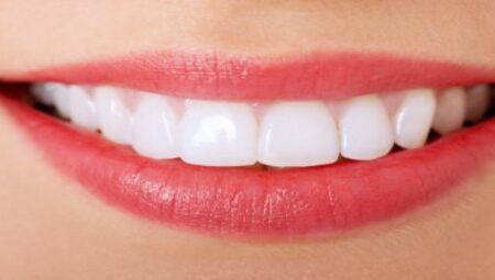 Kırmızı halıda görünmeyebilirsiniz ama dişlerinizi diş minenize zarar vermeden nasıl beyazlatacağınızı bilmekten zarar gelmez…