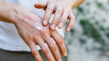 Kuru Eller İçin İdeal Çözüm: Yüksek Performanslı Nemlendirici Krem