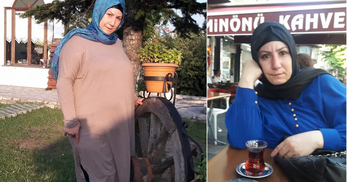 Kan donduran olay: Mide küçültme ameliyatı sonrası kızını okuldan dönerken ölü bulan anne!